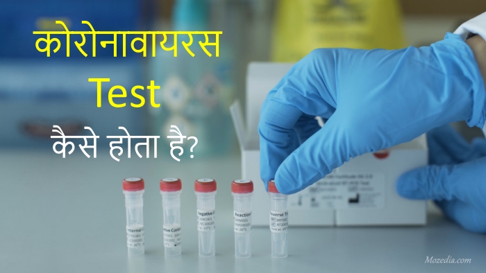 Coronavirus test